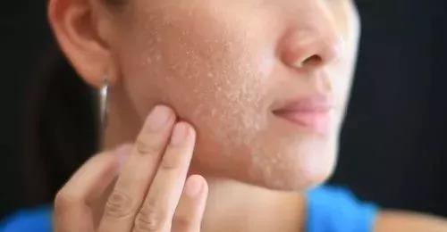 含胸低头走路 隐藏的健康风险与缺氧眩晕的关联